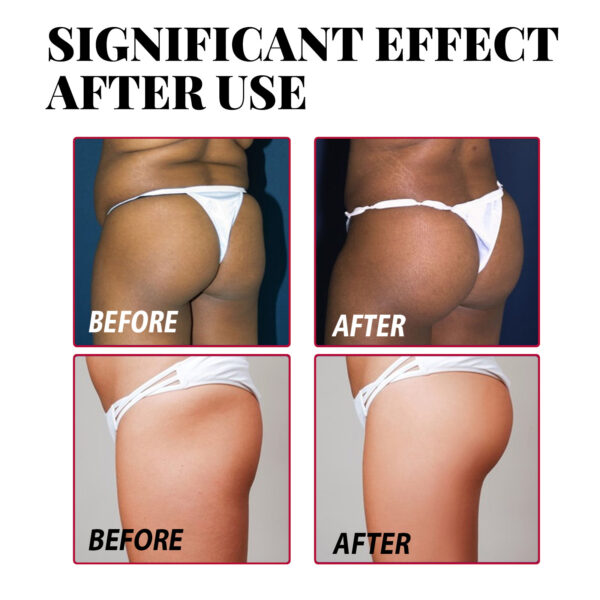 Plump Buttock Cream Lifts And Tightens Buttocks - Image 8