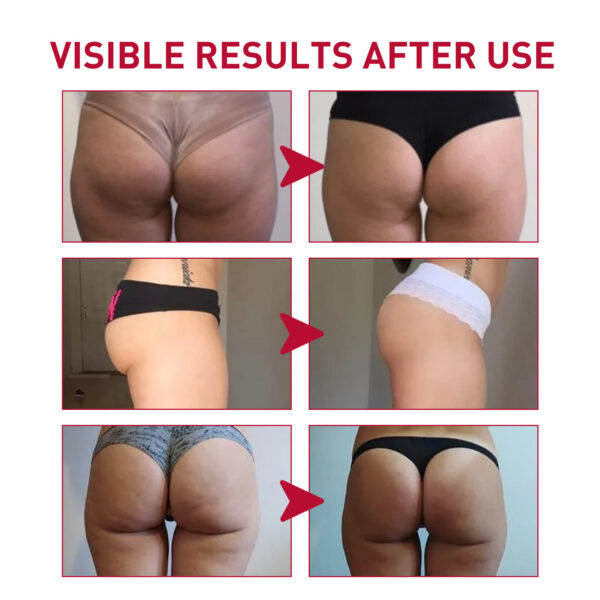 Plump Buttock Cream Lifts And Tightens Buttocks - Image 3