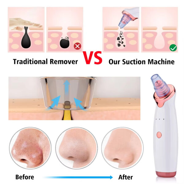 Blackhead Remover Pore Acne Pimple Removal Face T Zone Nose Water Bubble Cleaner Vacuum Suction Facial Diamond Steamer Oil Dirty - Image 2