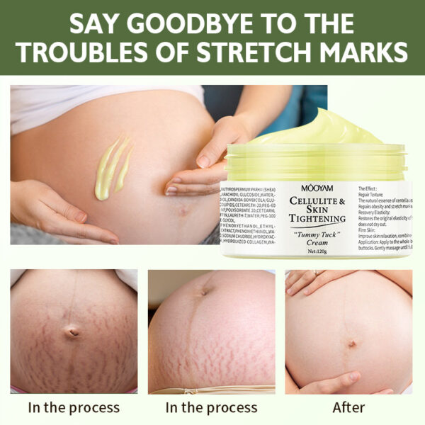 Stretch Mark Cream Fat Body Pattern Recovery Cream - Image 5