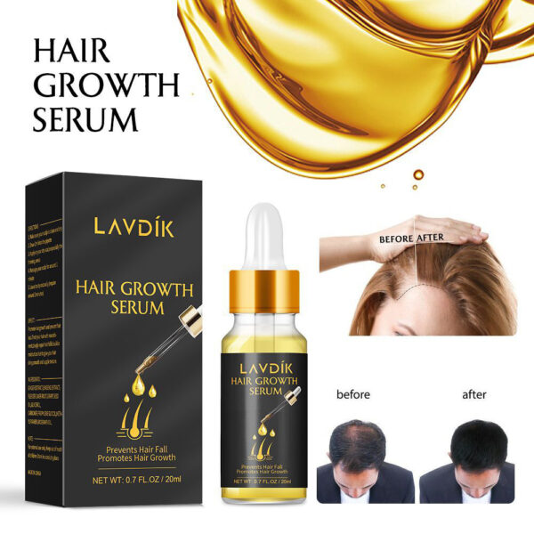 Damaged Hair Repair Women Men's Fast Hair Growth Essence Oil Anti-hair Loss Lotion - Image 3