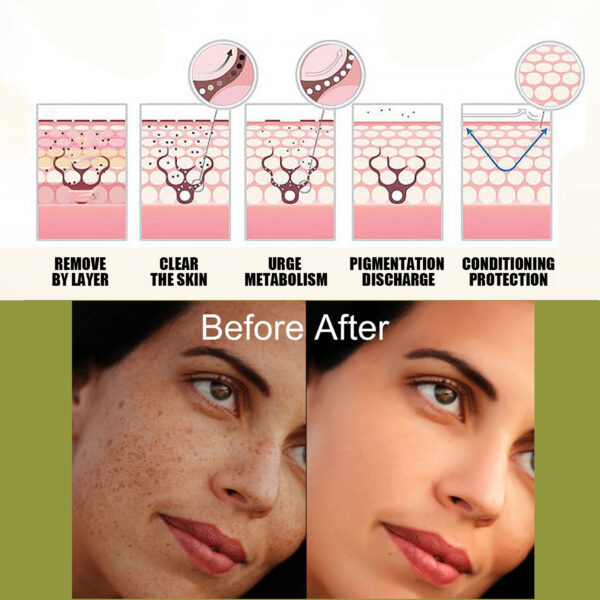 Fade Spot Repair Skin Dull Whitening Skin Lightening Cream - Image 3