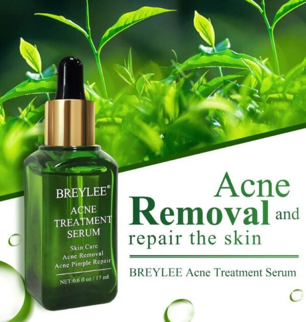 Acne Treatment Serum Facial Repair Oil - Image 5