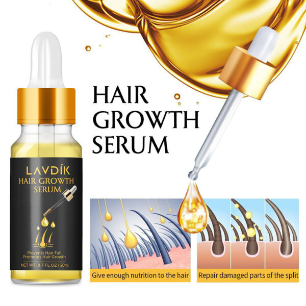 Damaged Hair Repair Women Men's Fast Hair Growth Essence Oil Anti-hair Loss Lotion - Image 5