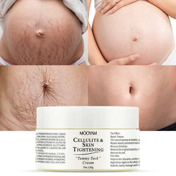 Stretch Mark Cream Fat Body Pattern Recovery Cream