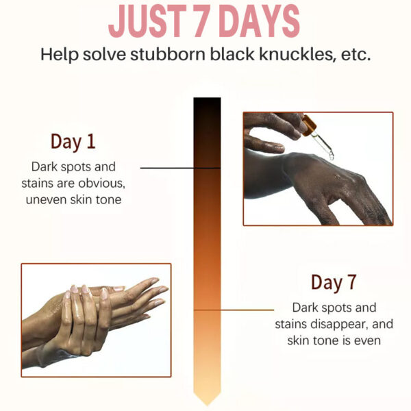 Universal Finger Brightening Nourishing Moisturizing - Image 3