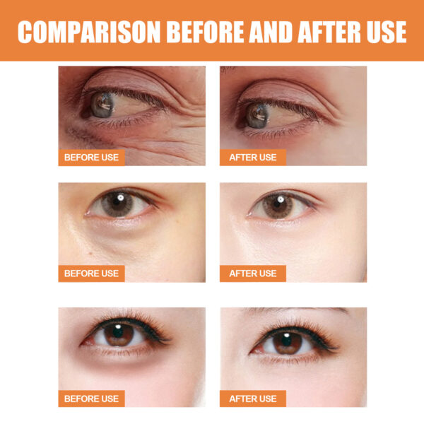 Vitamin C Eye Cream Stick Firming Skin Moisturizing - Image 3